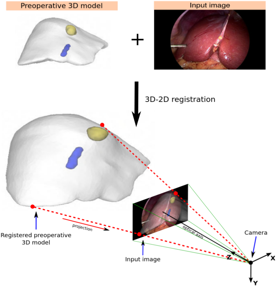 Hepataug project 3D-2D registration pipeline[cite: 2]